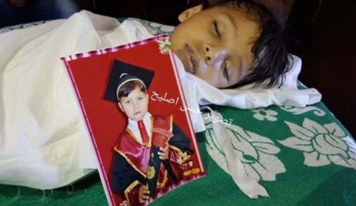 Gazze ablukasnn son kurban 5 yandaki Muhammed