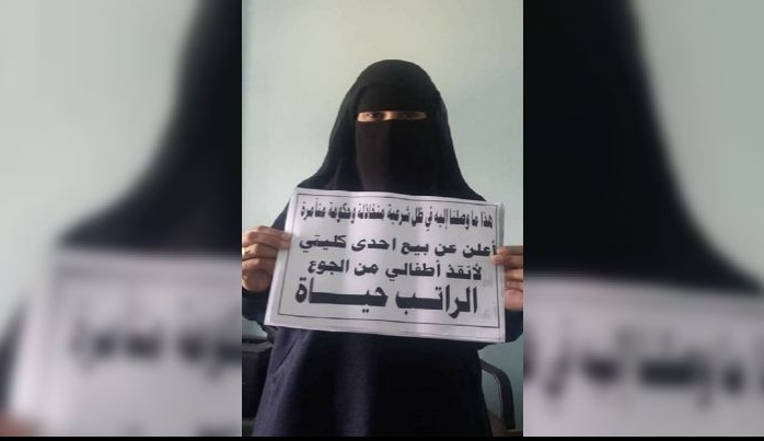 Yemen'li anne ocuklar iin bbreini sata kartt